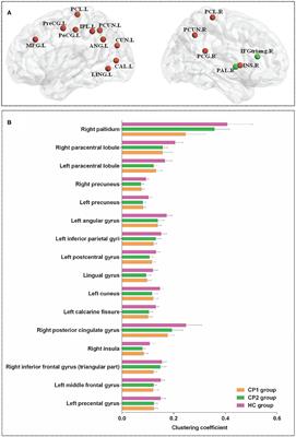 Changes of Structural Brain Network Following Repetitive Transcranial Magnetic Stimulation in Children With Bilateral Spastic Cerebral Palsy: A Diffusion Tensor Imaging Study